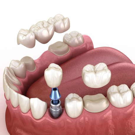 Zahn - Zahnarztpraxis Ashraf Türky aus Bullay