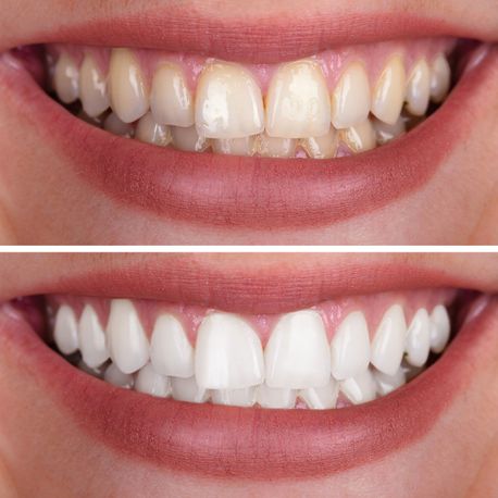 Zähne - Zahnarztpraxis Ashraf Türky aus Bullay